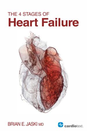 Cover of the book The 4 Stages of Heart Failure by N. A. Mark Estes III, MD, Albert Waldo, MD, PhD (Hon)