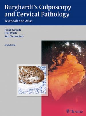bigCover of the book Burghardt's Colposcopy and Cervical Pathology by 
