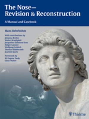 Cover of the book The Nose - Revision and Reconstruction by Thanh Hoang-Xuan, Catherine Creuzot-Garcher
