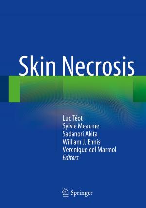 Cover of the book Skin Necrosis by Nikolai Kolev, Günter Huemer, Michael Zimpfer