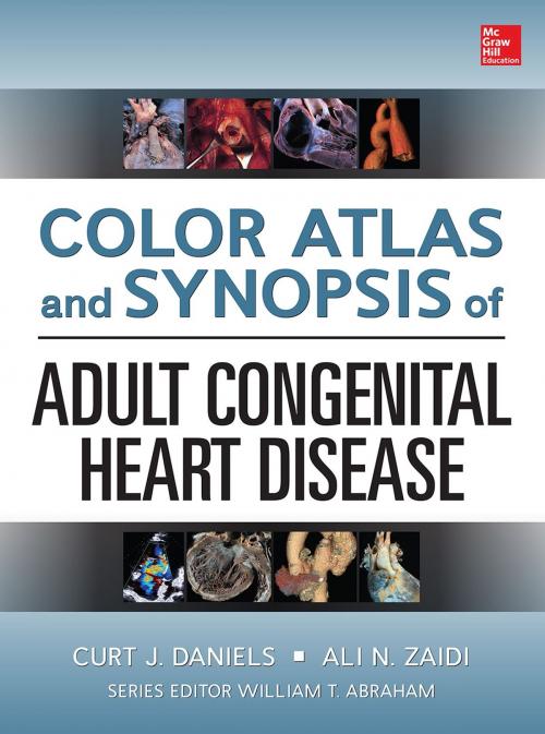 Cover of the book Color Atlas and Synopsis of Adult Congenital Heart Disease by Curt Daniels, Curt Daniels, Ali N Zaidi, McGraw-Hill Education
