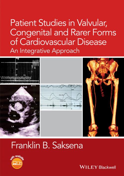 Cover of the book Patient Studies in Valvular, Congenital, and Rarer Forms of Cardiovascular Disease by Franklin B. Saksena, Wiley