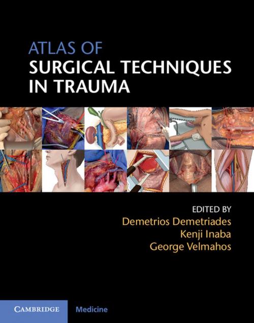 Cover of the book Atlas of Surgical Techniques in Trauma by , Cambridge University Press
