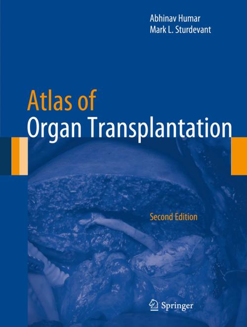 Cover of the book Atlas of Organ Transplantation by , Springer London
