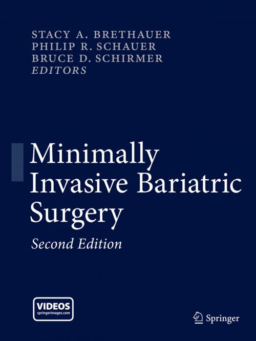 Cover of the book Minimally Invasive Bariatric Surgery by , Springer New York