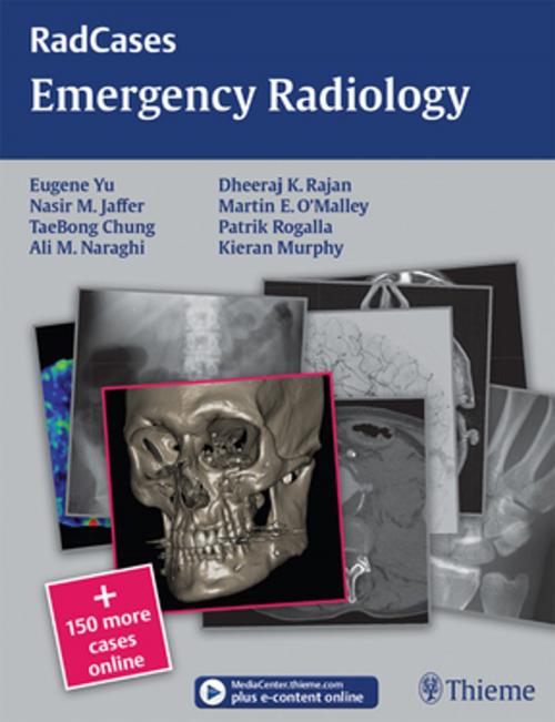 Cover of the book Emergency Radiology by Eugene Yu, Nasir Jaffer, TaeBong Chung, Thieme