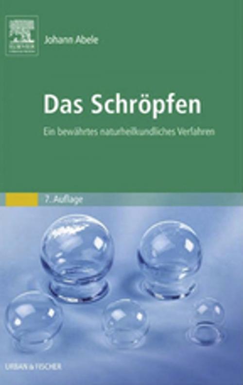 Cover of the book Das Schröpfen by Johann Abele, Elsevier Health Sciences