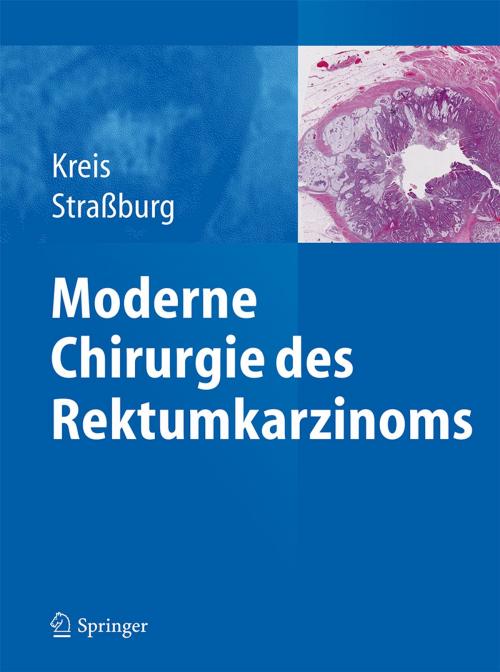 Cover of the book Moderne Chirurgie des Rektumkarzinoms by , Springer Berlin Heidelberg