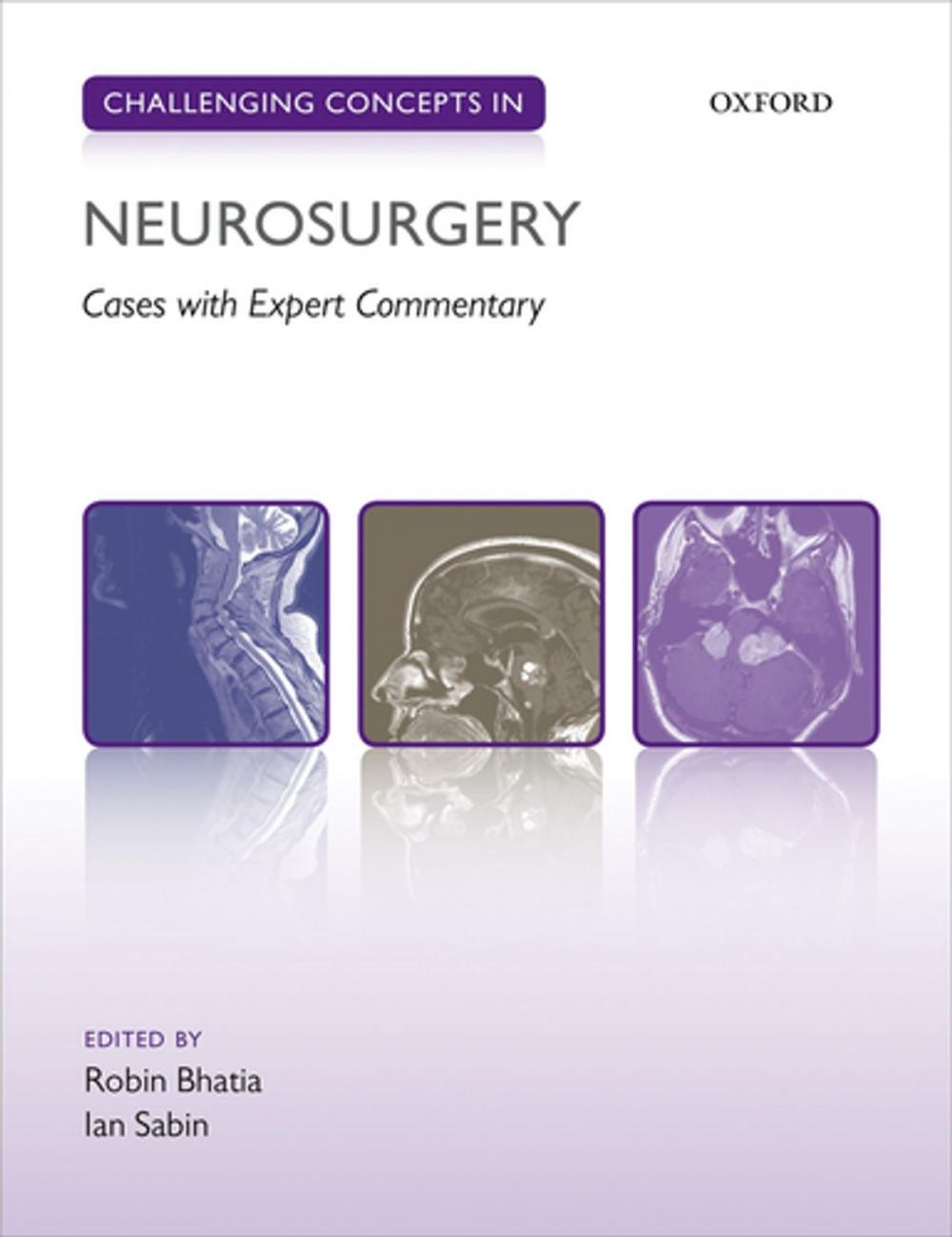 Big bigCover of Challenging Concepts in Neurosurgery