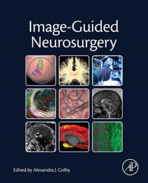 Cover of the book Image-Guided Neurosurgery by William S. Hoar, David J. Randall, George Iwama, Teruyuki Nakanishi