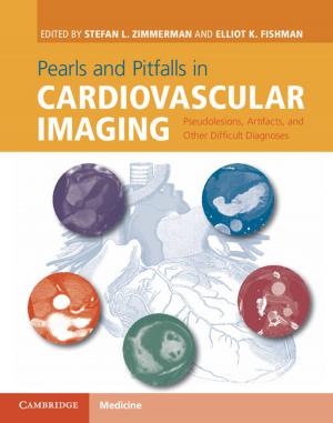 Cover of the book Pearls and Pitfalls in Cardiovascular Imaging by Frederick A. Lenz, Kenneth L. Casey, Edward G. Jones, William D. Willis