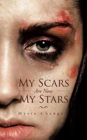 Cover of the book My Scars Are Now My Stars by Pieter Kriel