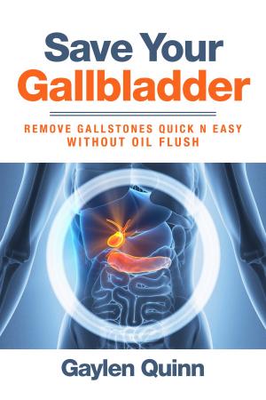Cover of the book Save Your Gallbladder (Remove Gallstones Quick n Easy Without Oil Flush) by Dennis Holt