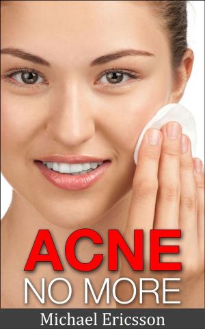 Book cover of Acne No More