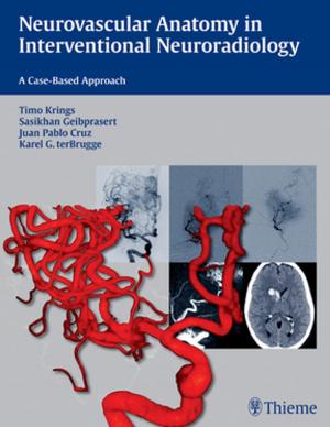 Cover of the book Neurovascular Anatomy in Interventional Neuroradiology: A Case-Based Approach by Ulrich Drews