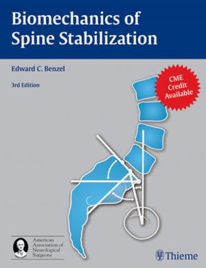 Cover of the book Biomechanics of Spine Stabilization by Mario Sanna, Rolien Free, Paul Merkus
