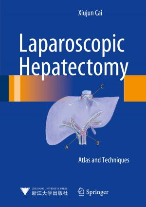 Cover of the book Laparoscopic Hepatectomy by F. Rapp