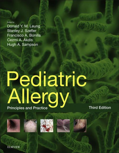 Cover of the book Pediatric Allergy: Principles and Practice E-Book by Hugh Sampson, Cezmi A Akdis, Stanley J. Szefler, MD, Francisco A Bonilla, MD, PhD, Elsevier Health Sciences