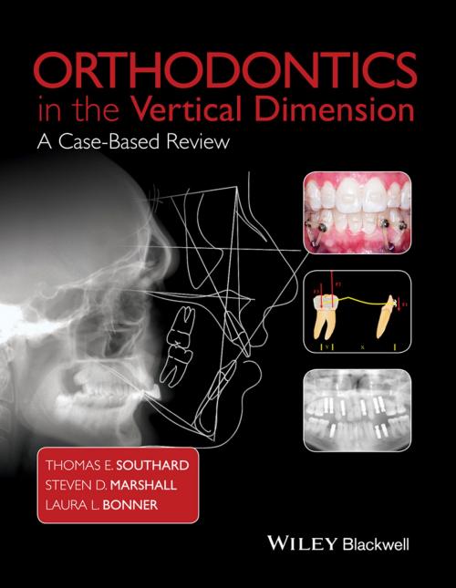 Cover of the book Orthodontics in the Vertical Dimension by Thomas E. Southard, Steven D. Marshall, Laura L. Bonner, Wiley