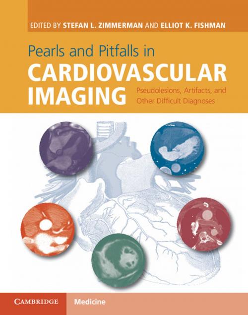 Cover of the book Pearls and Pitfalls in Cardiovascular Imaging by , Cambridge University Press