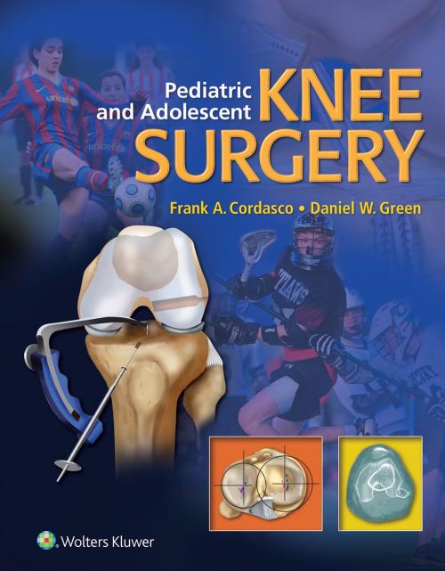 Cover of the book Pediatric and Adolescent Knee Surgery by Frank Cordasco, Daniel Green, Wolters Kluwer Health