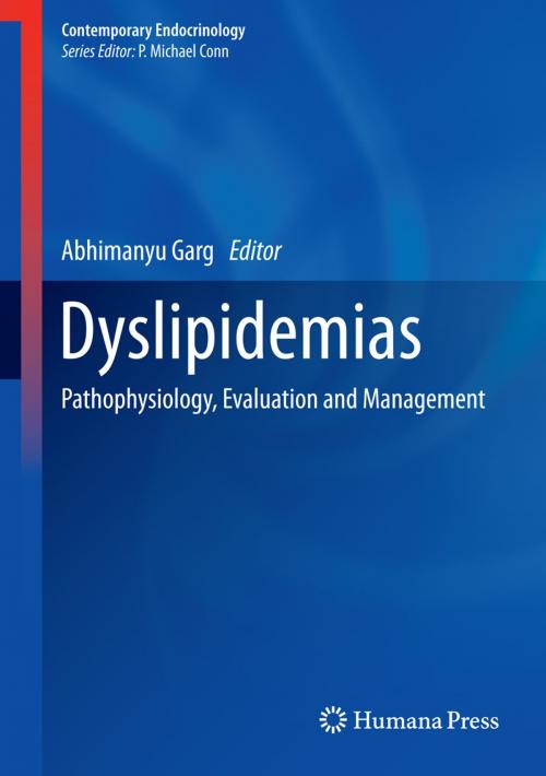 Cover of the book Dyslipidemias by , Humana Press