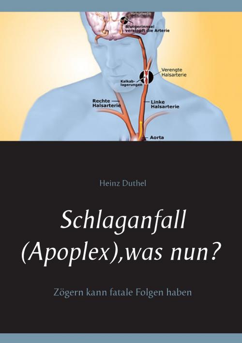 Cover of the book Schlaganfall (Apoplex), was nun? by Heinz Duthel, Books on Demand