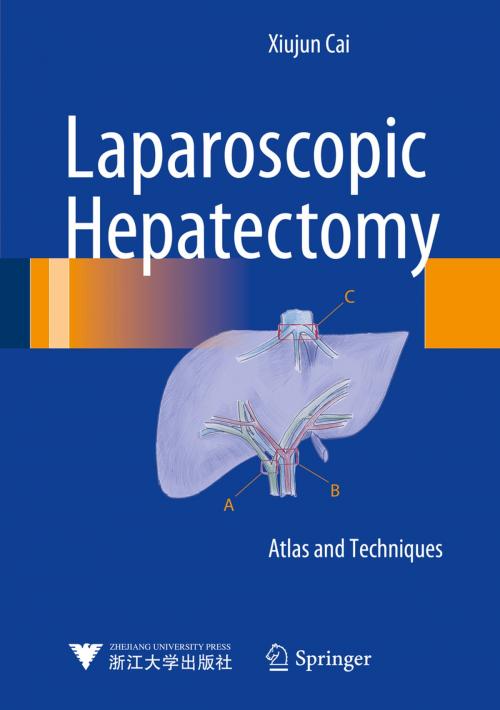 Cover of the book Laparoscopic Hepatectomy by Xiujun Cai, Springer Netherlands