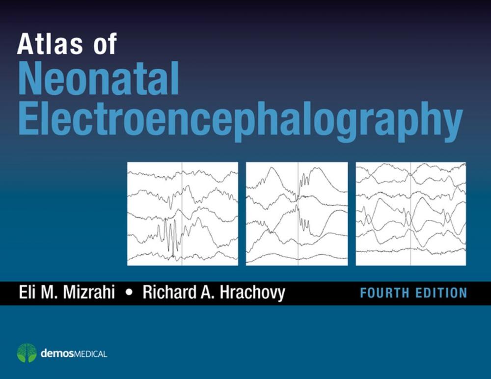Big bigCover of Atlas of Neonatal Electroencephalography, Fourth Edition