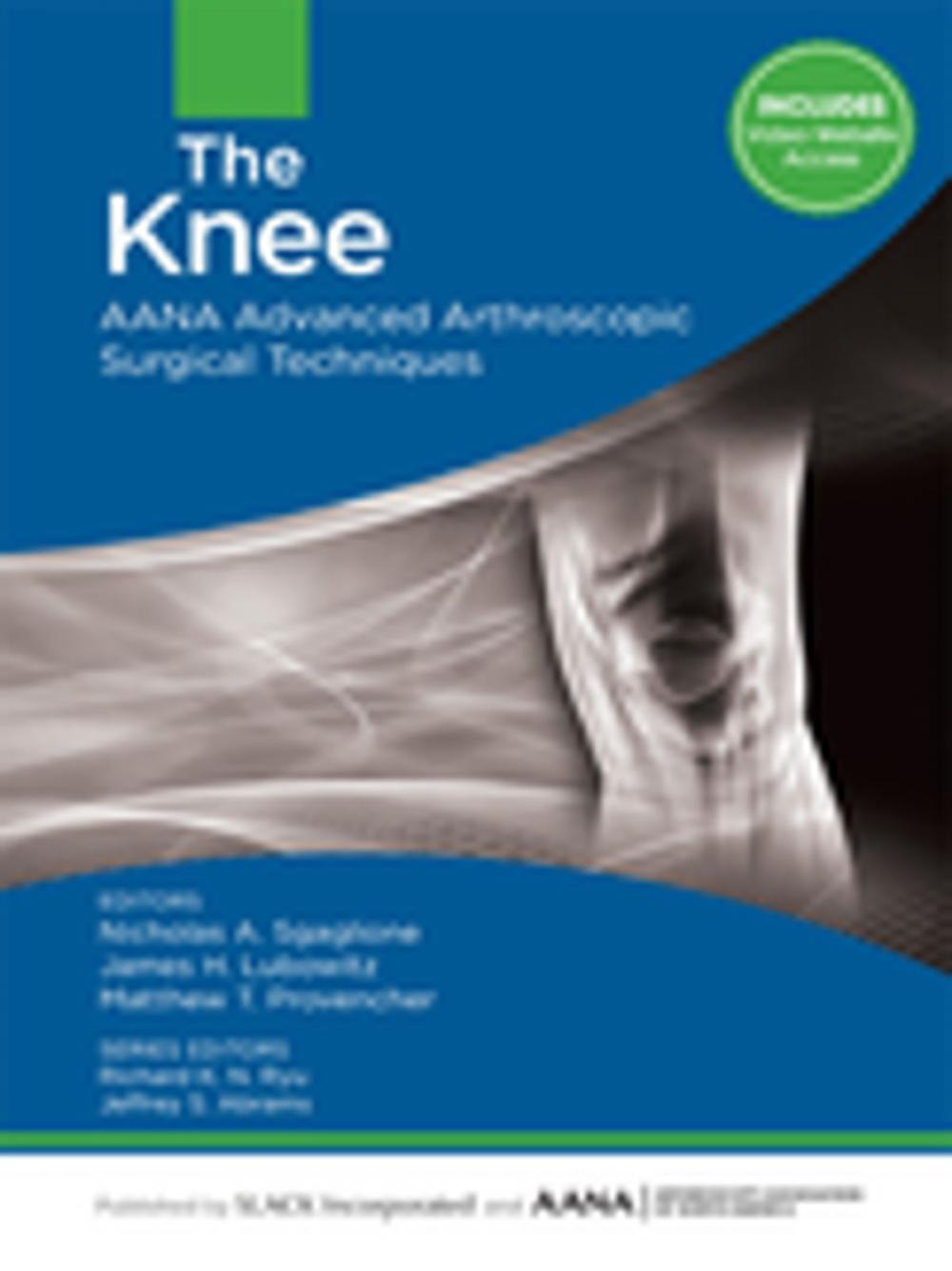 Big bigCover of The Knee