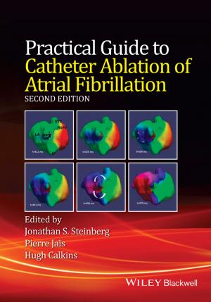 Cover of the book Practical Guide to Catheter Ablation of Atrial Fibrillation by CCPS (Center for Chemical Process Safety)