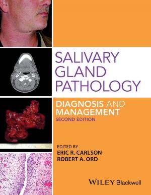 Cover of the book Salivary Gland Pathology by Catherine Thom