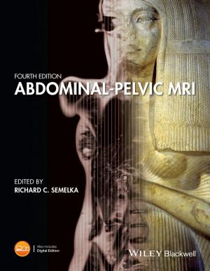 bigCover of the book Abdominal-Pelvic MRI by 