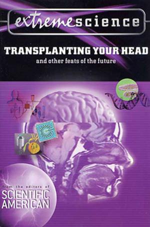 Book cover of Extreme Science: Transplanting Your Head