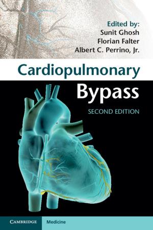 Cover of the book Cardiopulmonary Bypass by Matthew R. Begley, John W. Hutchinson