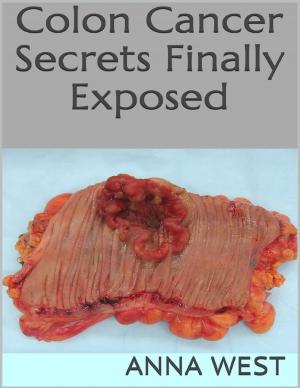 Cover of the book Colon Cancer Secrets Finally Exposed by Karen Hogan