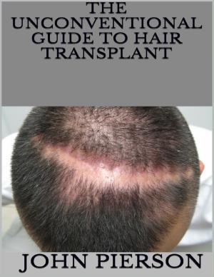 Cover of the book The Unconventional Guide to Hair Transplant by Daniel Gough