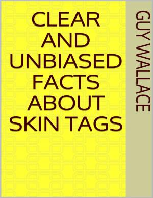 Book cover of Clear and Unbiased Facts About Skin Tags