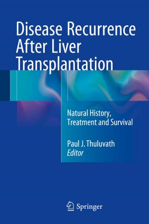 Cover of the book Disease Recurrence After Liver Transplantation by Prabhat Mishra, Heon-Mo Koo, Mingsong Chen, Xiaoke Qin