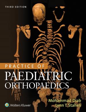 Book cover of Practice of Paediatric Orthopaedics