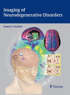 Cover of the book Imaging of Neurodegenerative Disorders by 