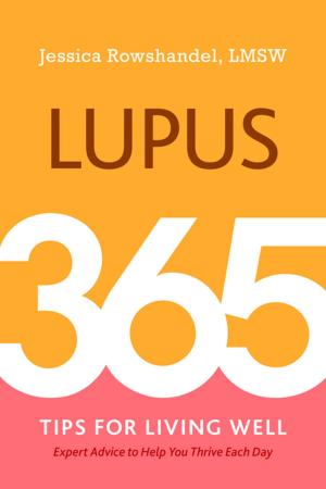 Cover of the book Lupus by Nina Kolbe