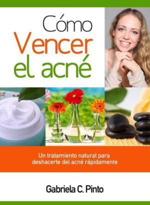 Cover of the book Cómo Vencer el Acné by Josué Rodríguez