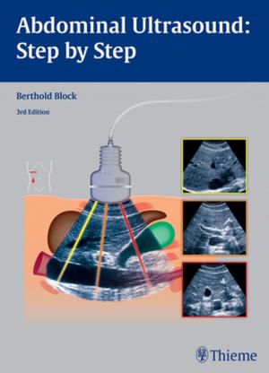 Cover of the book Abdominal Ultrasound: Step by Step by Yingze Zhang