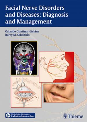 Book cover of Facial Nerve Disorders and Diseases: Diagnosis and Management