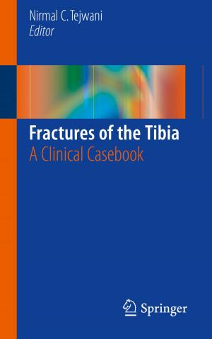Cover of the book Fractures of the Tibia by Akshay Kumar, Ahmed Abdelhadi, T. Charles Clancy