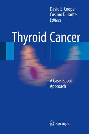 Cover of the book Thyroid Cancer by Jorge Luis García-Alcaraz, Aide Aracely Maldonado-Macias, Arturo Realyvásquez Vargas