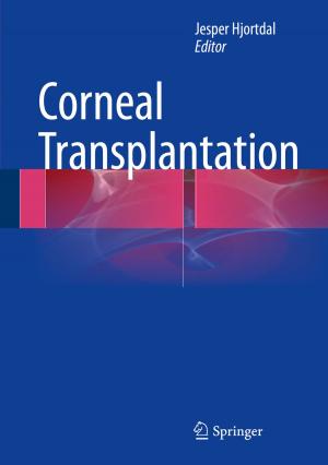 Cover of the book Corneal Transplantation by Carla P. Davis