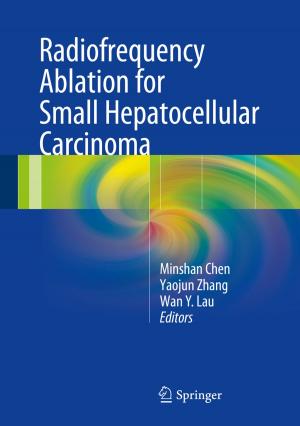 Cover of the book Radiofrequency Ablation for Small Hepatocellular Carcinoma by José Manuel Valverde Millán