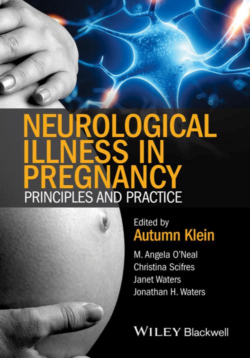 Cover of the book Neurological Illness in Pregnancy by M. Angela O'Neal, Christina Scifres, Janet Waters, Jonathan H. Waters, Wiley